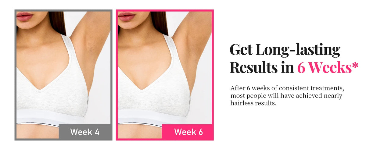 Laser Beauty Pro – Épilateur IPL Haute Performance