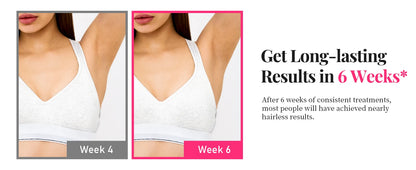 Laser Beauty Pro – Épilateur IPL Haute Performance