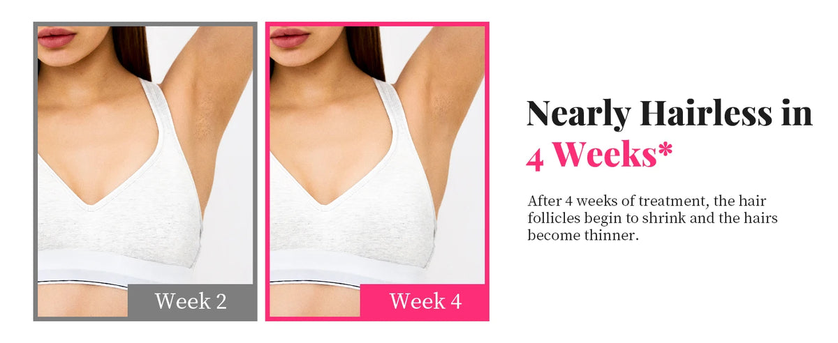 Laser Beauty Pro – Épilateur IPL Haute Performance